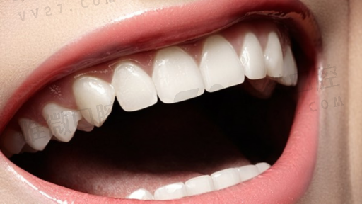 种植牙自体骨移植（牙齿自体骨植骨）(图1)